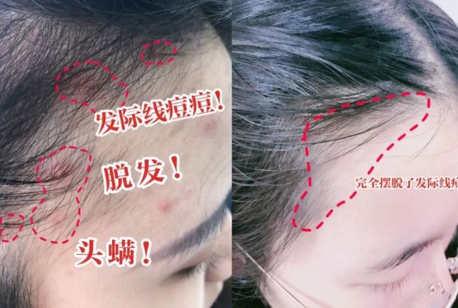 洗完头自然风干还是吹干好？10分钟轻松养成女明星「绸缎发」(图9)